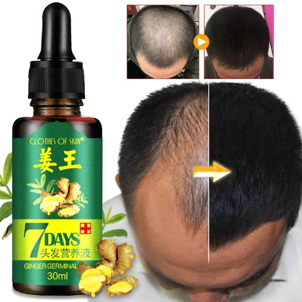 7 Day Ginger Germinal Oil Hair Nutrient Solution