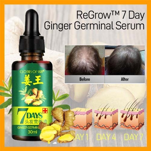 7 Day Ginger Germinal Oil Hair Nutrient Solution