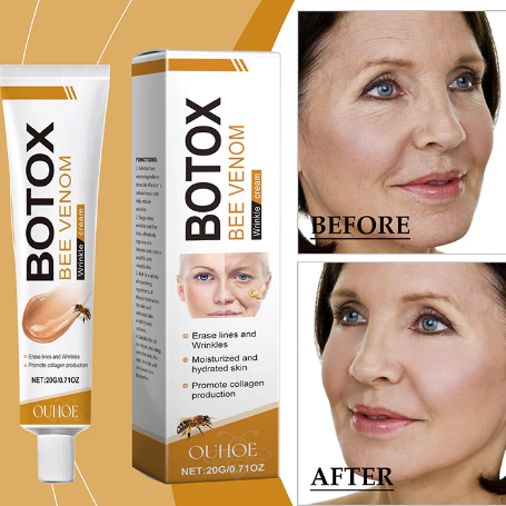 Botox Bee Venom Wrinkle Removal - Organic Habibi
