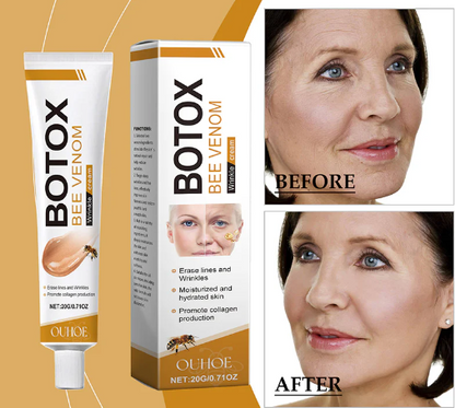 Botox Bee Venom Wrinkle Removal