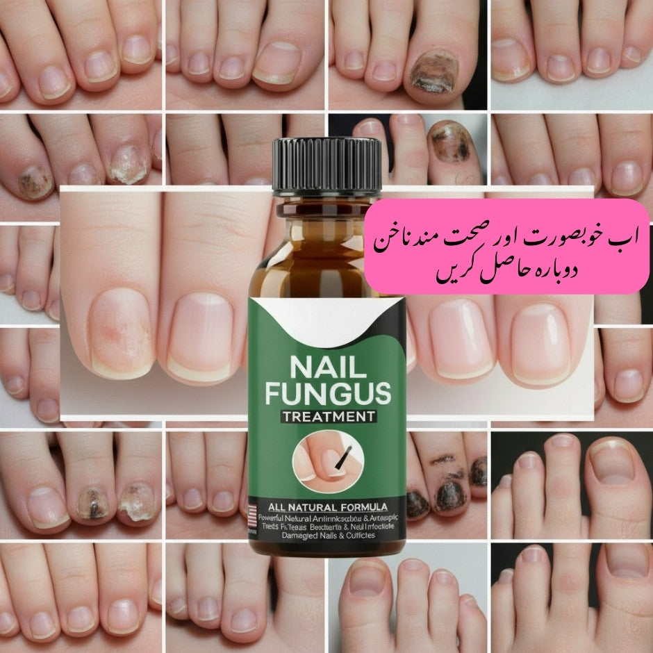 Fast Nail Fungus Treatment Serum _ Organic Nail Care - Organic Habibi